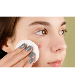 Hogyan minimalizáljuk a tág pórusokat és mitesszereket?