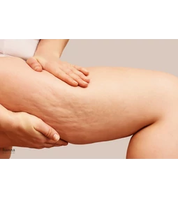 Lipout™ - Zsírbontó hatóanyag