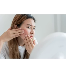 Rosaceára hajlamos bőr: van megoldás!